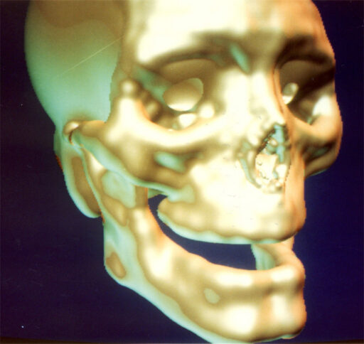 Links 1 osaka render image